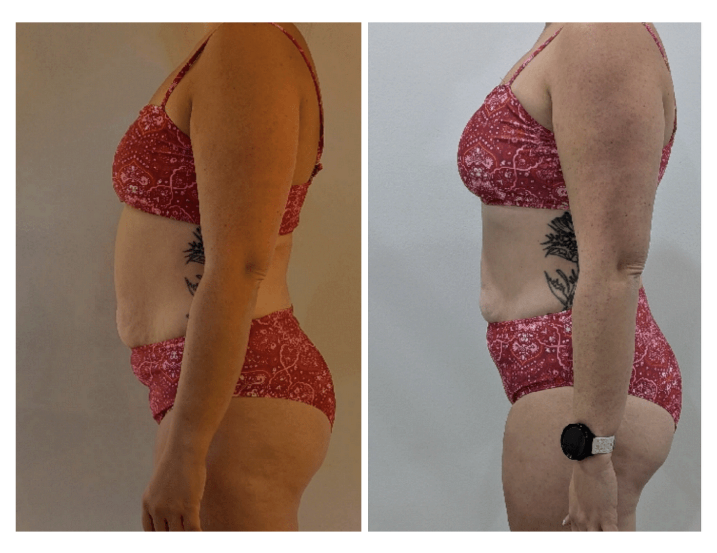 Ellen transformation