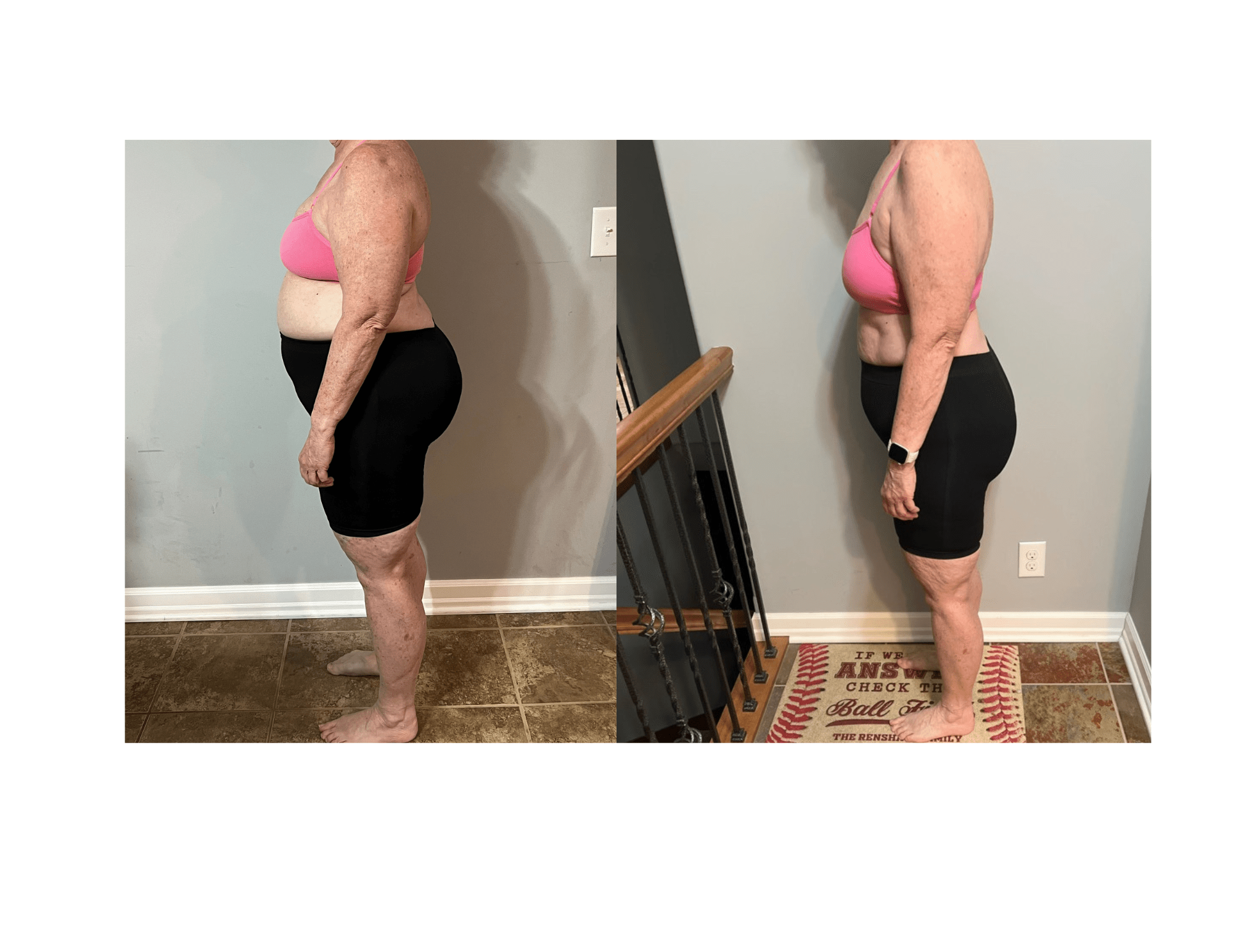Laurie's transformation